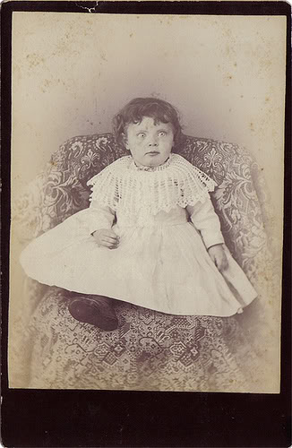 postmortem-false-eyes